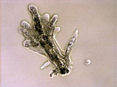  Reticulomyxa: Ein faszinierendes Ameboid mit unglaublichen Fähigkeiten, das sich durch seinen vielseitigen Lebensraum und seine komplexe Zellstruktur auszeichnet!